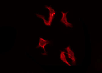 OR4A16 Antibody - Staining COLO205 cells by IF/ICC. The samples were fixed with PFA and permeabilized in 0.1% Triton X-100, then blocked in 10% serum for 45 min at 25°C. The primary antibody was diluted at 1:200 and incubated with the sample for 1 hour at 37°C. An Alexa Fluor 594 conjugated goat anti-rabbit IgG (H+L) Ab, diluted at 1/600, was used as the secondary antibody.