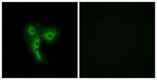 OR4A4 + OR4A47 Antibody - Immunofluorescence analysis of A549 cells, using OR4A4/4A47 Antibody. The picture on the right is blocked with the synthesized peptide.