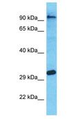OR4A47 Antibody - OR4A47 antibody Western Blot of MCF7. Antibody dilution: 1 ug/ml.  This image was taken for the unconjugated form of this product. Other forms have not been tested.