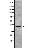 OR4A47 Antibody - Western blot analysis OR4A47 using HeLa whole cells lysates