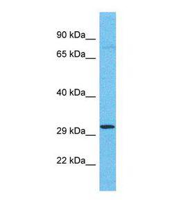OR4C11 Antibody - Western blot of Human 721_B. OR4C11 antibody dilution 1.0 ug/ml.  This image was taken for the unconjugated form of this product. Other forms have not been tested.
