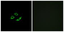 OR4C12 Antibody - Immunofluorescence analysis of A549 cells, using OR4C12 Antibody. The picture on the right is blocked with the synthesized peptide.