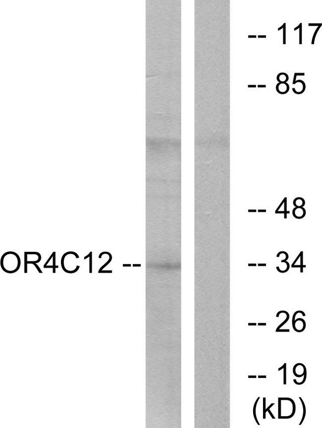 OR4C12 Antibody - Western blot analysis of lysates from Jurkat cells, using OR4C12 Antibody. The lane on the right is blocked with the synthesized peptide.