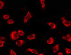 OR4C12 Antibody - Staining HeLa cells by IF/ICC. The samples were fixed with PFA and permeabilized in 0.1% Triton X-100, then blocked in 10% serum for 45 min at 25°C. The primary antibody was diluted at 1:200 and incubated with the sample for 1 hour at 37°C. An Alexa Fluor 594 conjugated goat anti-rabbit IgG (H+L) Ab, diluted at 1/600, was used as the secondary antibody.