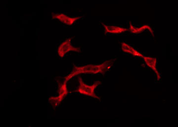 OR4C13 Antibody - Staining HeLa cells by IF/ICC. The samples were fixed with PFA and permeabilized in 0.1% Triton X-100, then blocked in 10% serum for 45 min at 25°C. The primary antibody was diluted at 1:200 and incubated with the sample for 1 hour at 37°C. An Alexa Fluor 594 conjugated goat anti-rabbit IgG (H+L) Ab, diluted at 1/600, was used as the secondary antibody.