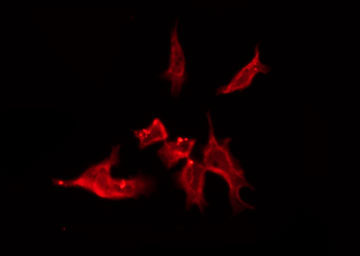 OR4C15 Antibody - Staining HeLa cells by IF/ICC. The samples were fixed with PFA and permeabilized in 0.1% Triton X-100, then blocked in 10% serum for 45 min at 25°C. The primary antibody was diluted at 1:200 and incubated with the sample for 1 hour at 37°C. An Alexa Fluor 594 conjugated goat anti-rabbit IgG (H+L) Ab, diluted at 1/600, was used as the secondary antibody.