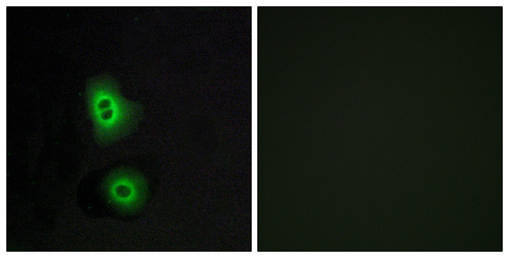 OR4C16 Antibody - Immunofluorescence analysis of A549 cells, using OR4C16 Antibody. The picture on the right is blocked with the synthesized peptide.