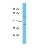OR4C16 Antibody - Western blot of Human COLO205. OR4C16 antibody dilution 1.0 ug/ml.  This image was taken for the unconjugated form of this product. Other forms have not been tested.