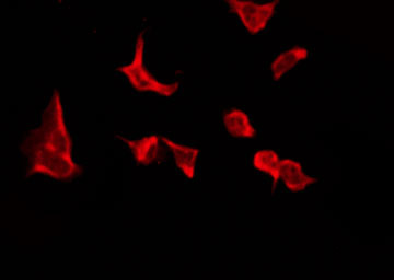 OR4C16 Antibody - Staining LOVO cells by IF/ICC. The samples were fixed with PFA and permeabilized in 0.1% Triton X-100, then blocked in 10% serum for 45 min at 25°C. The primary antibody was diluted at 1:200 and incubated with the sample for 1 hour at 37°C. An Alexa Fluor 594 conjugated goat anti-rabbit IgG (H+L) Ab, diluted at 1/600, was used as the secondary antibody.