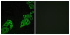 OR4C3 Antibody - Immunofluorescence analysis of A549 cells, using OR4C3 Antibody. The picture on the right is blocked with the synthesized peptide.