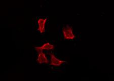 OR4C3 Antibody - Staining HeLa cells by IF/ICC. The samples were fixed with PFA and permeabilized in 0.1% Triton X-100, then blocked in 10% serum for 45 min at 25°C. The primary antibody was diluted at 1:200 and incubated with the sample for 1 hour at 37°C. An Alexa Fluor 594 conjugated goat anti-rabbit IgG (H+L) Ab, diluted at 1/600, was used as the secondary antibody.