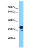 OR4C45 Antibody - OR4C45 antibody Western Blot of HT1080. Antibody dilution: 1 ug/ml.  This image was taken for the unconjugated form of this product. Other forms have not been tested.