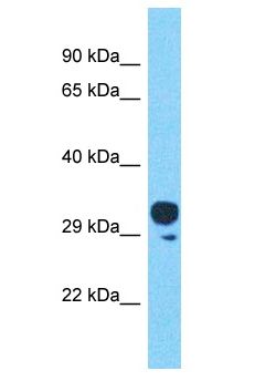 OR4C45 Antibody - OR4C45 antibody Western Blot of HT1080. Antibody dilution: 1 ug/ml.  This image was taken for the unconjugated form of this product. Other forms have not been tested.