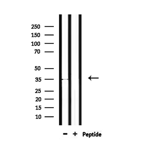 OR4C46 Antibody - Western blot analysis of extracts of rat muscle using OR4C46 antibody.