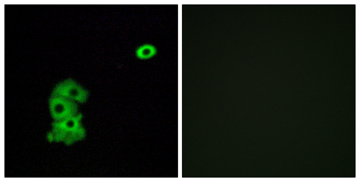 OR4C6 Antibody - Immunofluorescence analysis of A549 cells, using OR4C6 Antibody. The picture on the right is blocked with the synthesized peptide.