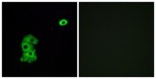 OR4C6 Antibody - Immunofluorescence analysis of A549 cells, using OR4C6 Antibody. The picture on the right is blocked with the synthesized peptide.