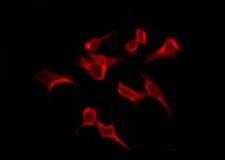 OR4C6 Antibody - Staining HeLa cells by IF/ICC. The samples were fixed with PFA and permeabilized in 0.1% Triton X-100, then blocked in 10% serum for 45 min at 25°C. The primary antibody was diluted at 1:200 and incubated with the sample for 1 hour at 37°C. An Alexa Fluor 594 conjugated goat anti-rabbit IgG (H+L) Ab, diluted at 1/600, was used as the secondary antibody.