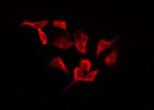 OR4D1 Antibody - Staining HeLa cells by IF/ICC. The samples were fixed with PFA and permeabilized in 0.1% Triton X-100, then blocked in 10% serum for 45 min at 25°C. The primary antibody was diluted at 1:200 and incubated with the sample for 1 hour at 37°C. An Alexa Fluor 594 conjugated goat anti-rabbit IgG (H+L) Ab, diluted at 1/600, was used as the secondary antibody.