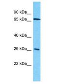 OR4D10 Antibody - OR4D10 antibody Western Blot of HepG2. Antibody dilution: 1 ug/ml.  This image was taken for the unconjugated form of this product. Other forms have not been tested.