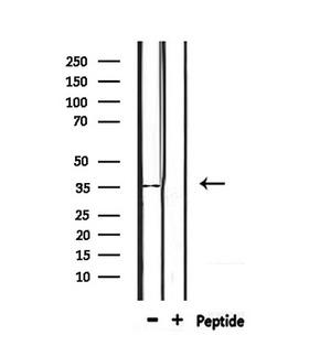 OR4D2 Antibody - Western blot analysis of extracts of mouse spleen using OR4D2 antibody.