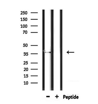 OR4D5 Antibody - Western blot analysis of extracts of mouse brain tissue using OR4D5 antibody.