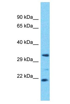 OR4D6 Antibody - OR4D6 antibody Western Blot of OVCAR-3. Antibody dilution: 1 ug/ml.  This image was taken for the unconjugated form of this product. Other forms have not been tested.