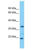 OR4D6 Antibody - OR4D6 antibody Western Blot of OVCAR-3. Antibody dilution: 1 ug/ml.  This image was taken for the unconjugated form of this product. Other forms have not been tested.