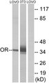 OR4D6 Antibody - Western blot analysis of lysates from LOVO and NIH/3T3 cells, using OR4D6 Antibody. The lane on the right is blocked with the synthesized peptide.