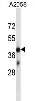 OR4D6 Antibody - OR4D6 Antibody western blot of A2058 cell line lysates (35 ug/lane). The OR4D6 antibody detected the OR4D6 protein (arrow).