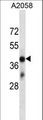 OR4D6 Antibody - OR4D6 Antibody western blot of A2058 cell line lysates (35 ug/lane). The OR4D6 antibody detected the OR4D6 protein (arrow).