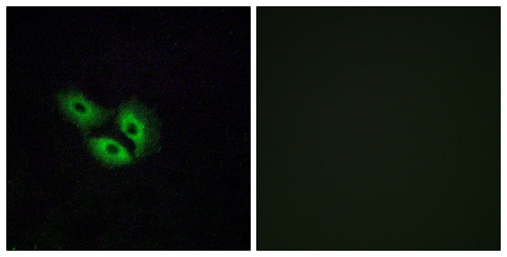 OR4E2 Antibody - Immunofluorescence analysis of A549 cells, using OR4E2 Antibody. The picture on the right is blocked with the synthesized peptide.
