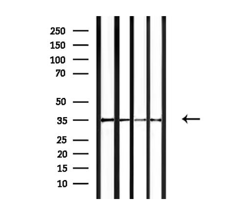 OR4F15 Antibody - Western blot analysis of extracts of mouse liver tissue and HepG2 and rat muscle and mouse spleen using OR4F15 antibody.