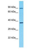 OR4F3 Antibody - OR4F3 antibody Western Blot of PANC1. Antibody dilution: 1 ug/ml.  This image was taken for the unconjugated form of this product. Other forms have not been tested.