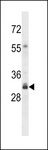 OR4F3 Antibody - OR4F16 Antibody western blot of Y79 cell line lysates (35 ug/lane). The OR4F16 antibody detected the OR4F16 protein (arrow).