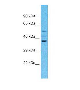 OR4F4 Antibody - Western blot of Human 721_B. OR4F4 antibody dilution 1.0 ug/ml.  This image was taken for the unconjugated form of this product. Other forms have not been tested.