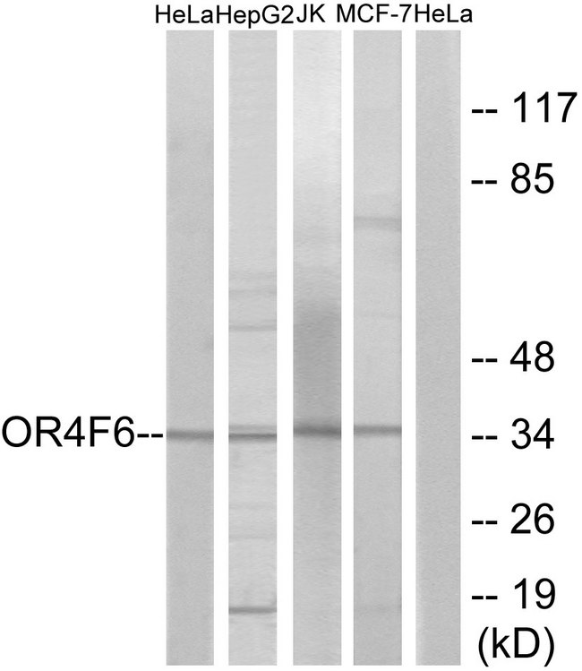 OR4F6 Antibody - Western blot analysis of lysates from HeLa, Jurkat, HepG2, and MCF-7 cells, using OR4F6 Antibody. The lane on the right is blocked with the synthesized peptide.