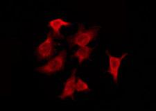OR4F6 Antibody - Staining HeLa cells by IF/ICC. The samples were fixed with PFA and permeabilized in 0.1% Triton X-100, then blocked in 10% serum for 45 min at 25°C. The primary antibody was diluted at 1:200 and incubated with the sample for 1 hour at 37°C. An Alexa Fluor 594 conjugated goat anti-rabbit IgG (H+L) Ab, diluted at 1/600, was used as the secondary antibody.
