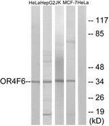 OR4F6 Antibody - Western blot analysis of extracts from HeLa cells, HepG2 cells, Jurkat cells and MCF-7 cells, using OR4F6 antibody.