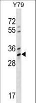 OR4K1 Antibody - OR4K1 Antibody western blot of Y79 cell line lysates (35 ug/lane). The OR4K1 antibody detected the OR4K1 protein (arrow).