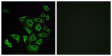 OR4K14 Antibody - Immunofluorescence analysis of A549 cells, using OR4K14 Antibody. The picture on the right is blocked with the synthesized peptide.