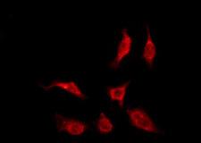 OR4K14 Antibody - Staining HeLa cells by IF/ICC. The samples were fixed with PFA and permeabilized in 0.1% Triton X-100, then blocked in 10% serum for 45 min at 25°C. The primary antibody was diluted at 1:200 and incubated with the sample for 1 hour at 37°C. An Alexa Fluor 594 conjugated goat anti-rabbit IgG (H+L) Ab, diluted at 1/600, was used as the secondary antibody.