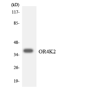 OR4K2 Antibody - Western blot analysis of the lysates from HT-29 cells using OR4K2 antibody.