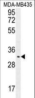 OR4K2 Antibody - OR4K2 Antibody western blot of MDA-MB435 cell line lysates (35 ug/lane). The OR4K2 antibody detected the OR4K2 protein (arrow).