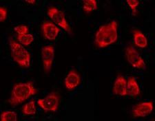 OR4K2 Antibody - Staining HeLa cells by IF/ICC. The samples were fixed with PFA and permeabilized in 0.1% Triton X-100, then blocked in 10% serum for 45 min at 25°C. The primary antibody was diluted at 1:200 and incubated with the sample for 1 hour at 37°C. An Alexa Fluor 594 conjugated goat anti-rabbit IgG (H+L) Ab, diluted at 1/600, was used as the secondary antibody.