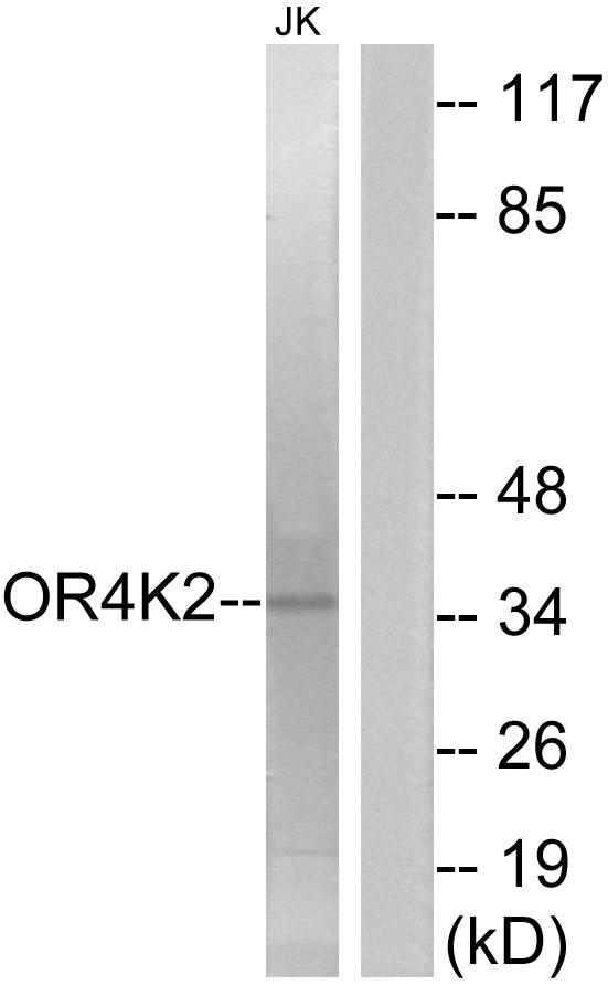 OR4K2 Antibody - Western blot analysis of extracts from Jurkat cells, using OR4K2 antibody.