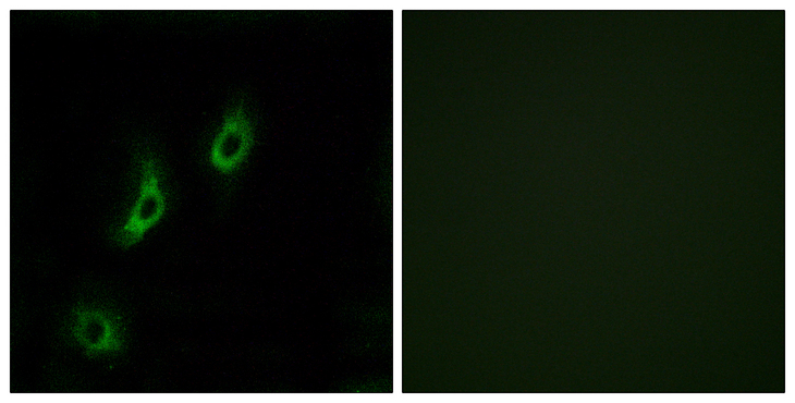 OR4L1 Antibody - Immunofluorescence analysis of COS7 cells, using OR4L1 Antibody. The picture on the right is blocked with the synthesized peptide.