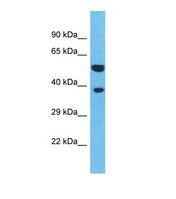 OR4L1 Antibody - Western blot of Human HeLa. OR4L1 antibody dilution 1.0 ug/ml.  This image was taken for the unconjugated form of this product. Other forms have not been tested.