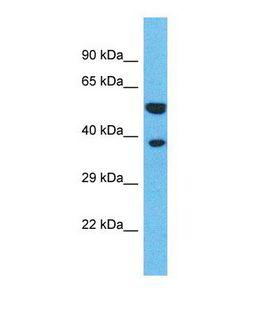 OR4L1 Antibody - Western blot of Human HeLa. OR4L1 antibody dilution 1.0 ug/ml.  This image was taken for the unconjugated form of this product. Other forms have not been tested.