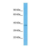 OR4M1 Antibody - Western blot of Human 721_B. OR4M1 antibody dilution 1.0 ug/ml.  This image was taken for the unconjugated form of this product. Other forms have not been tested.