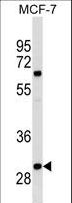 OR4M2 Antibody - OR4M2 Antibody western blot of MCF-7 cell line lysates (35 ug/lane). The OR4M2 antibody detected the OR4M2 protein (arrow).